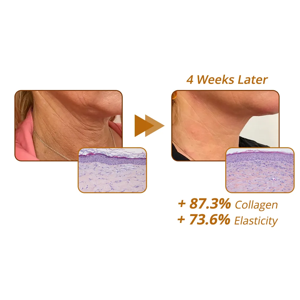 flysmus RevitaPeptid Reversal Serum