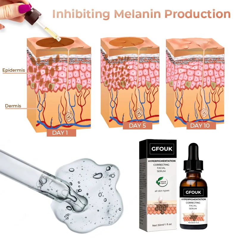 GFOUK Hyperpigmentation Correcting Facial Serum