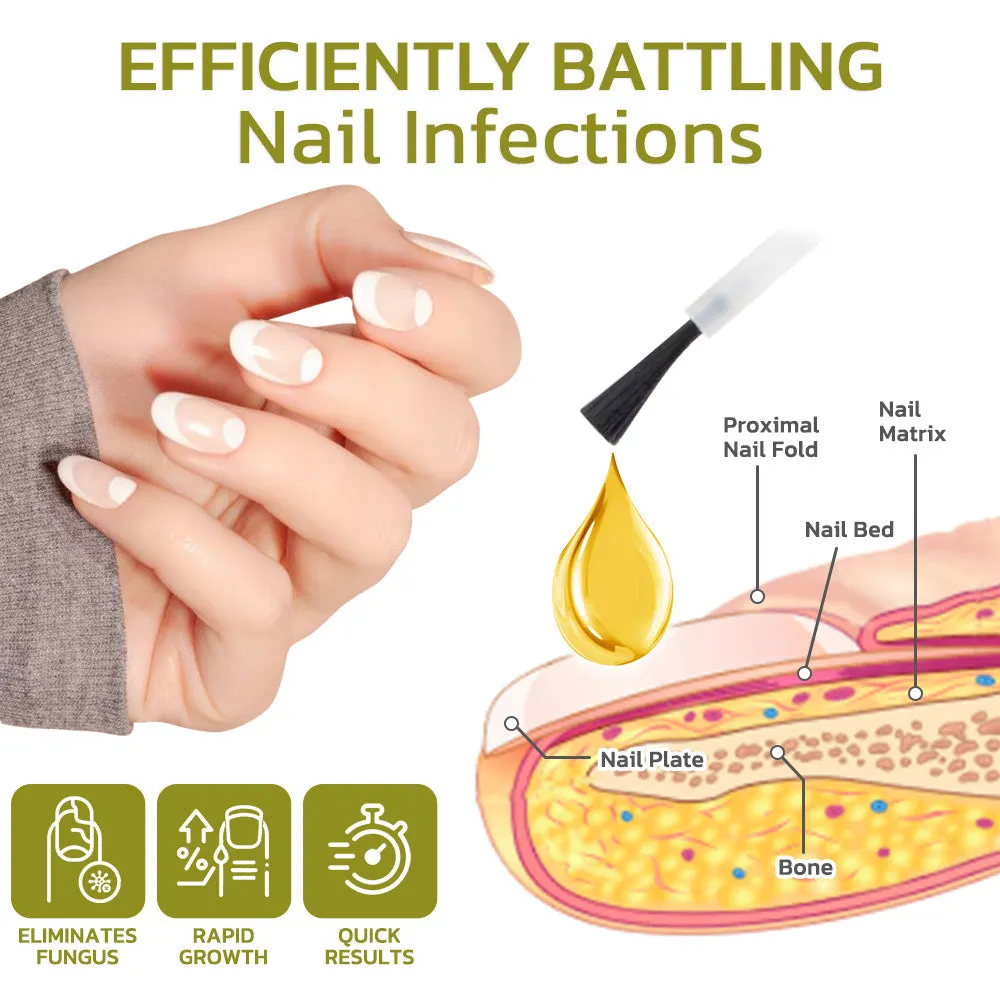GFOUK Intense Nail Growth and Strengthening Serum