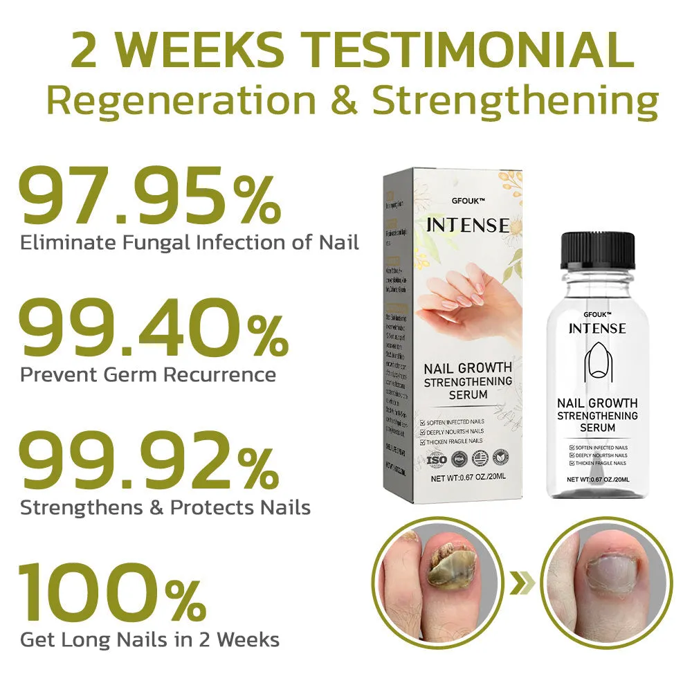 GFOUK Intense Nail Growth and Strengthening Serum