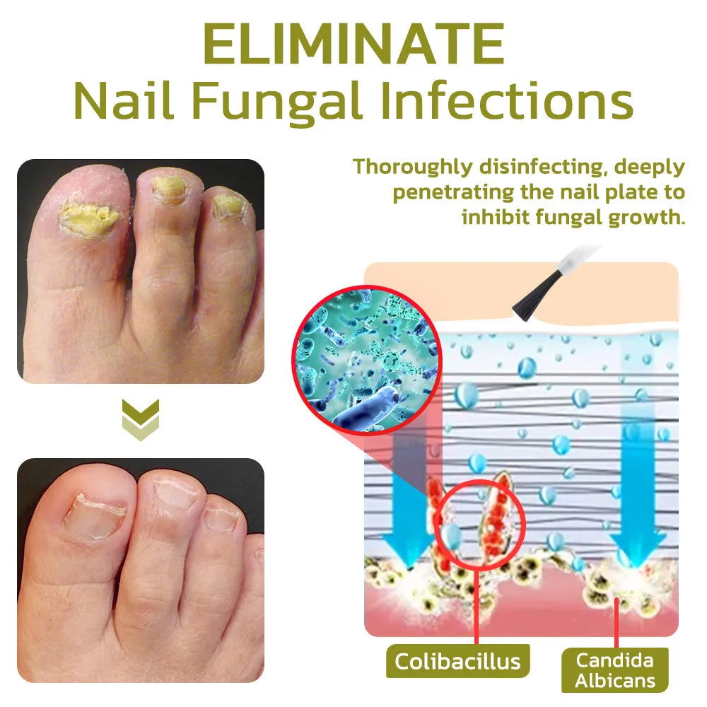 GFOUK Intense Nail Growth and Strengthening Serum