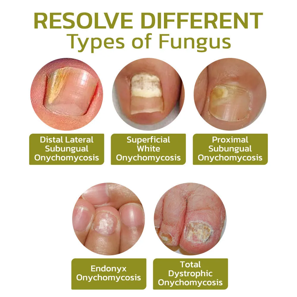 GFOUK Intense Nail Growth and Strengthening Serum